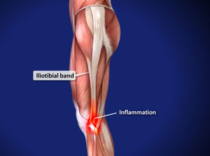 Sports Doctor Los Angeles