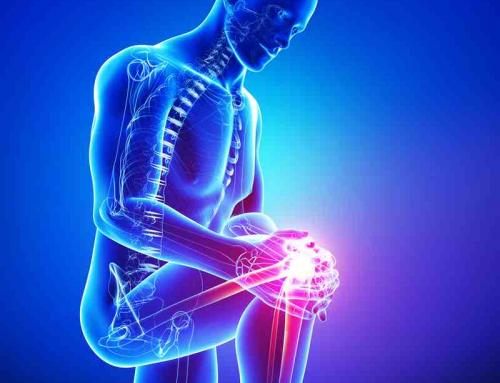 Basics of Knee Replacement