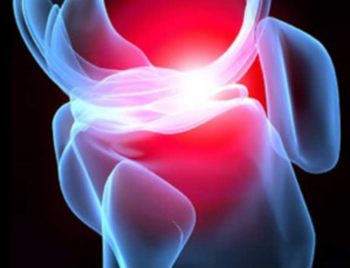 Cartilage Restoration Procedures with a Top Los Angeles Orthopedic Surgeon