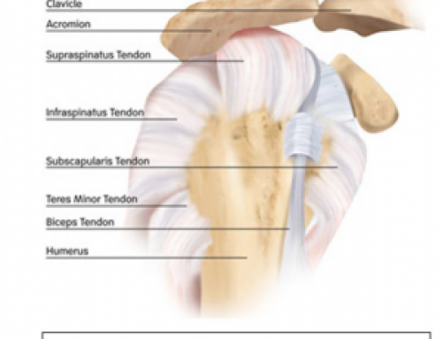 What to Expect During a Rotator Cuff Tendon Reconstruction Surgery