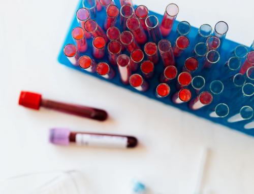Platelet-Rich Plasma Therapy